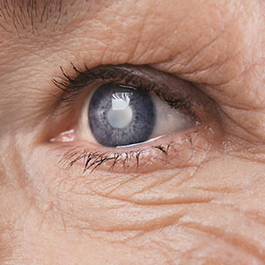 Ophthalmologist in Aventura